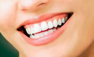Tìm hiểu về răng sứ thẩm mỹ